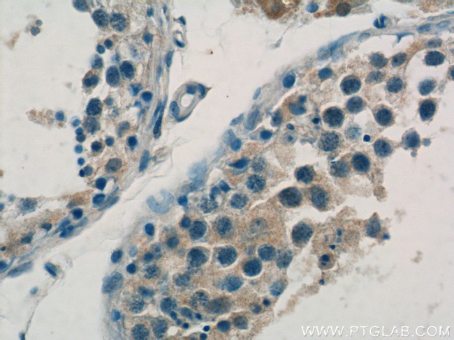 DAX-1 Antibody in Immunohistochemistry (Paraffin) (IHC (P))