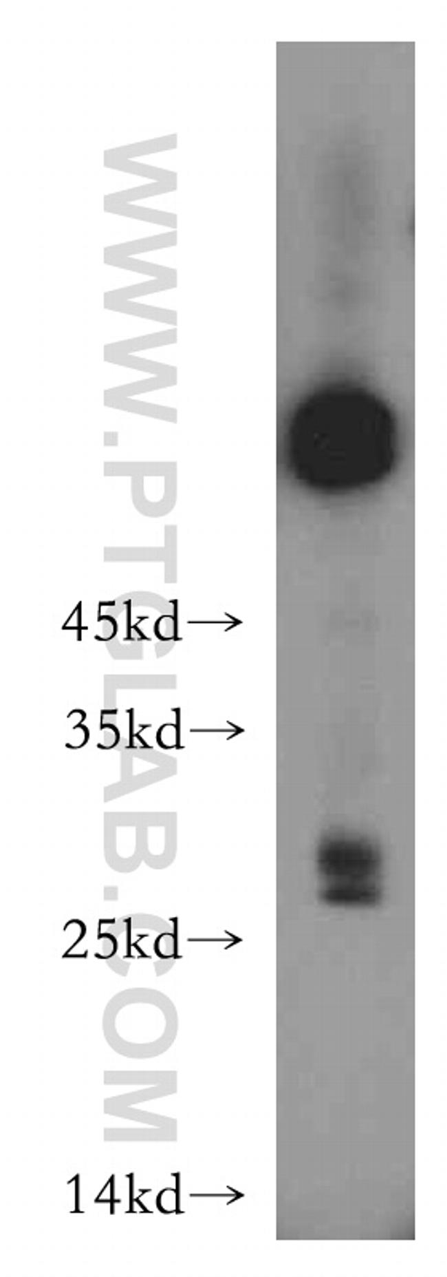 THAP2 Antibody in Western Blot (WB)