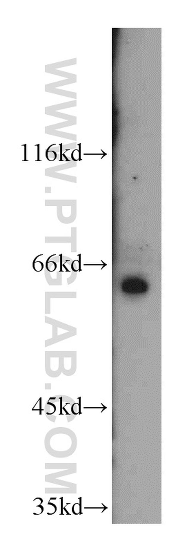 SLC38A4 Antibody in Western Blot (WB)