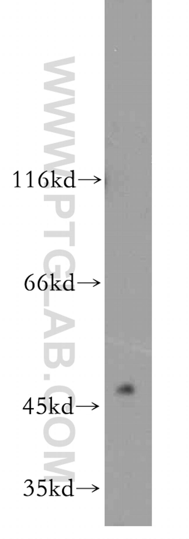 GABPB2 Antibody in Western Blot (WB)