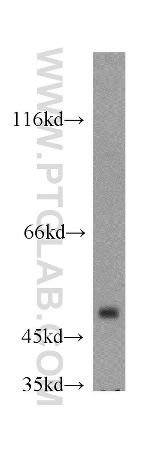 GABPB2 Antibody in Western Blot (WB)