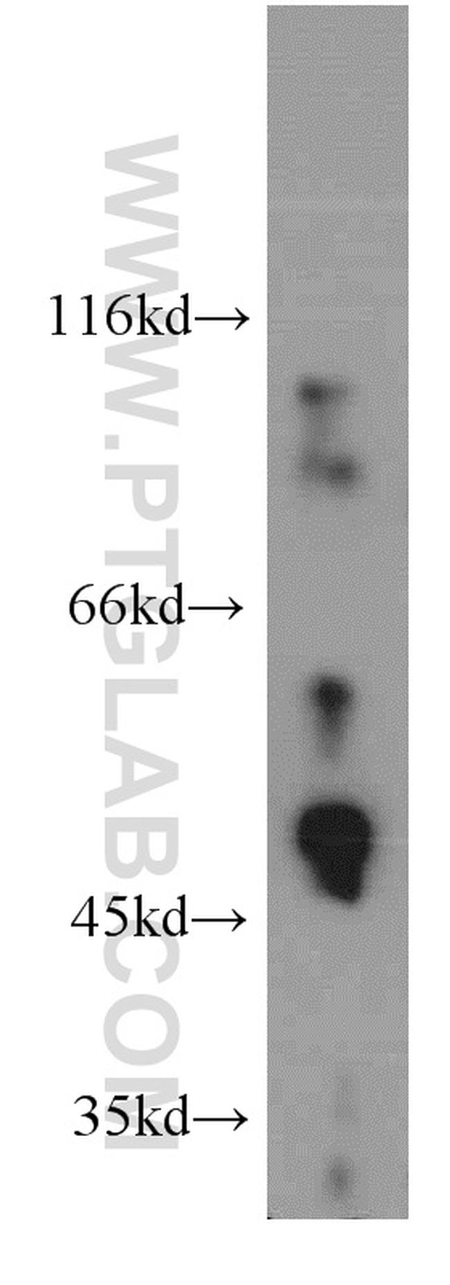 GABPB2 Antibody in Western Blot (WB)