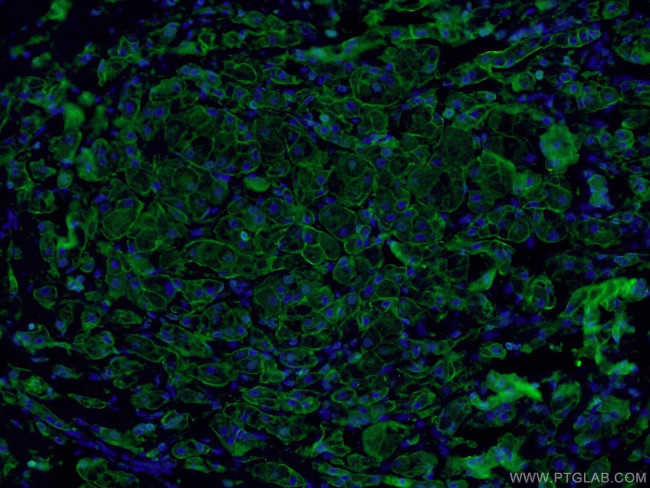 E-cadherin Antibody in Immunohistochemistry (PFA fixed) (IHC (PFA))