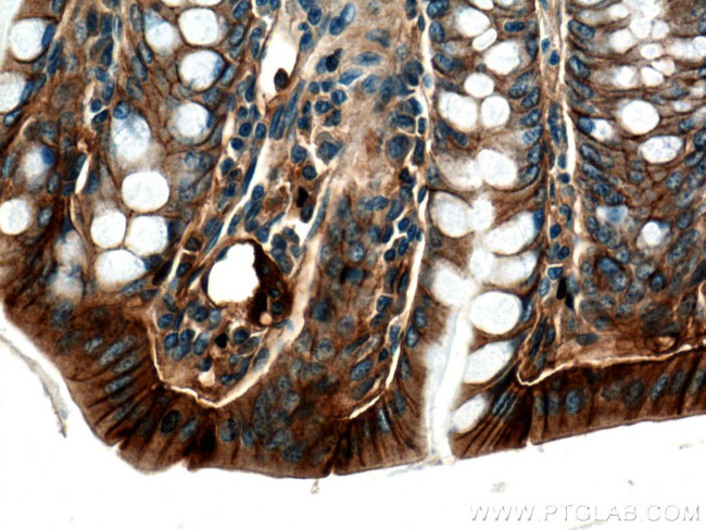 E-cadherin Antibody in Immunohistochemistry (Paraffin) (IHC (P))