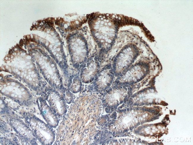 E-cadherin Antibody in Immunohistochemistry (Paraffin) (IHC (P))