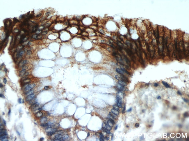 E-cadherin Antibody in Immunohistochemistry (Paraffin) (IHC (P))