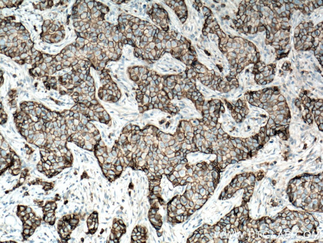 E-cadherin Antibody in Immunohistochemistry (Paraffin) (IHC (P))