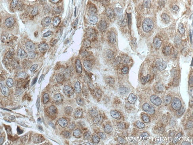 TTC19 Antibody in Immunohistochemistry (Paraffin) (IHC (P))