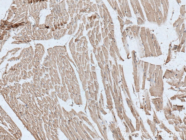 TTC19 Antibody in Immunohistochemistry (Paraffin) (IHC (P))