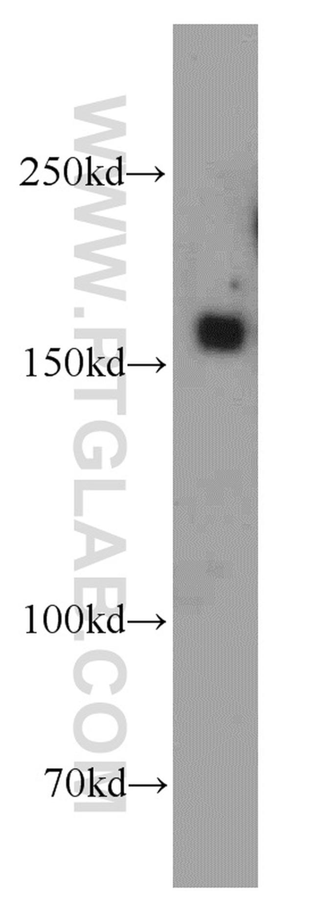 FGD5 Antibody in Western Blot (WB)