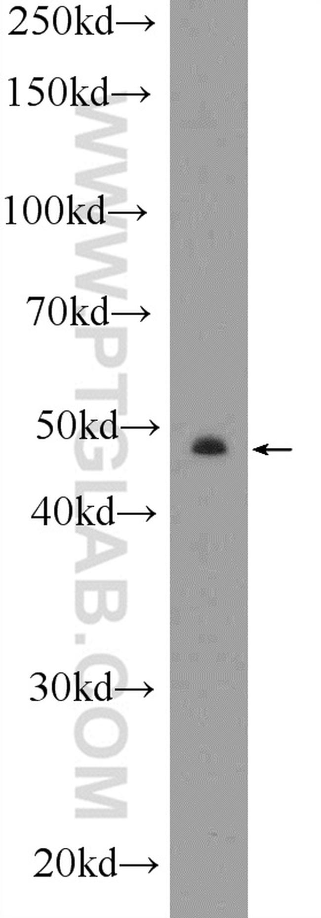 CYP11B2 Antibody in Western Blot (WB)