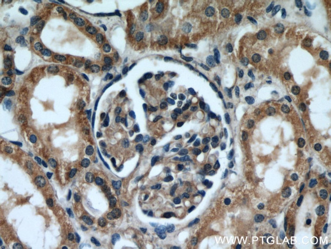 INSC Antibody in Immunohistochemistry (Paraffin) (IHC (P))