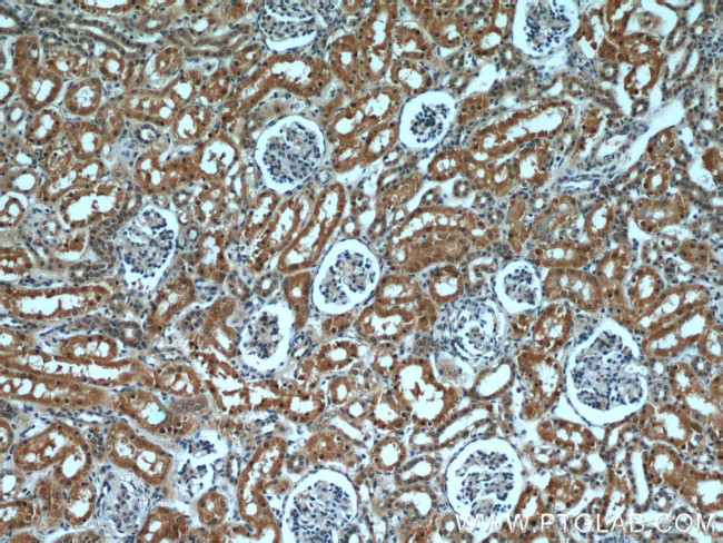 Raptor Antibody in Immunohistochemistry (Paraffin) (IHC (P))