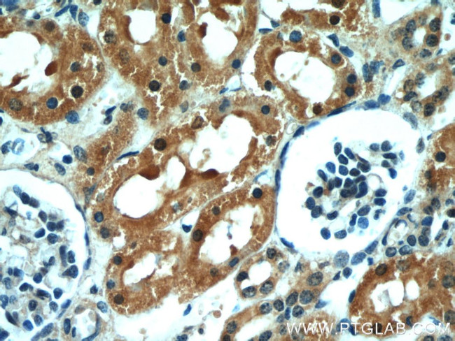 Raptor Antibody in Immunohistochemistry (Paraffin) (IHC (P))