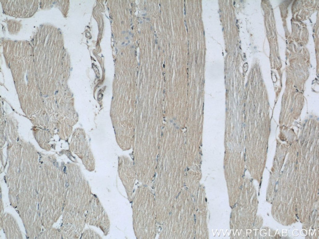 Raptor Antibody in Immunohistochemistry (Paraffin) (IHC (P))