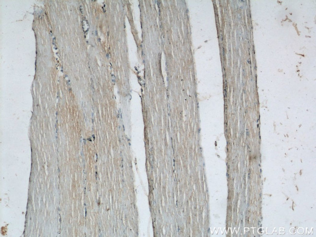 Raptor Antibody in Immunohistochemistry (Paraffin) (IHC (P))