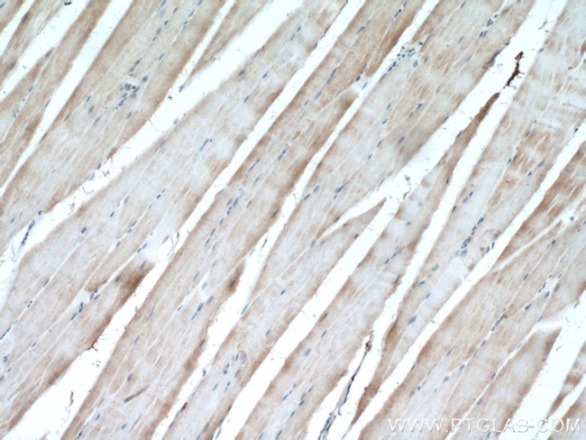 Raptor Antibody in Immunohistochemistry (Paraffin) (IHC (P))