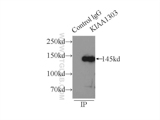 Raptor Antibody in Immunoprecipitation (IP)