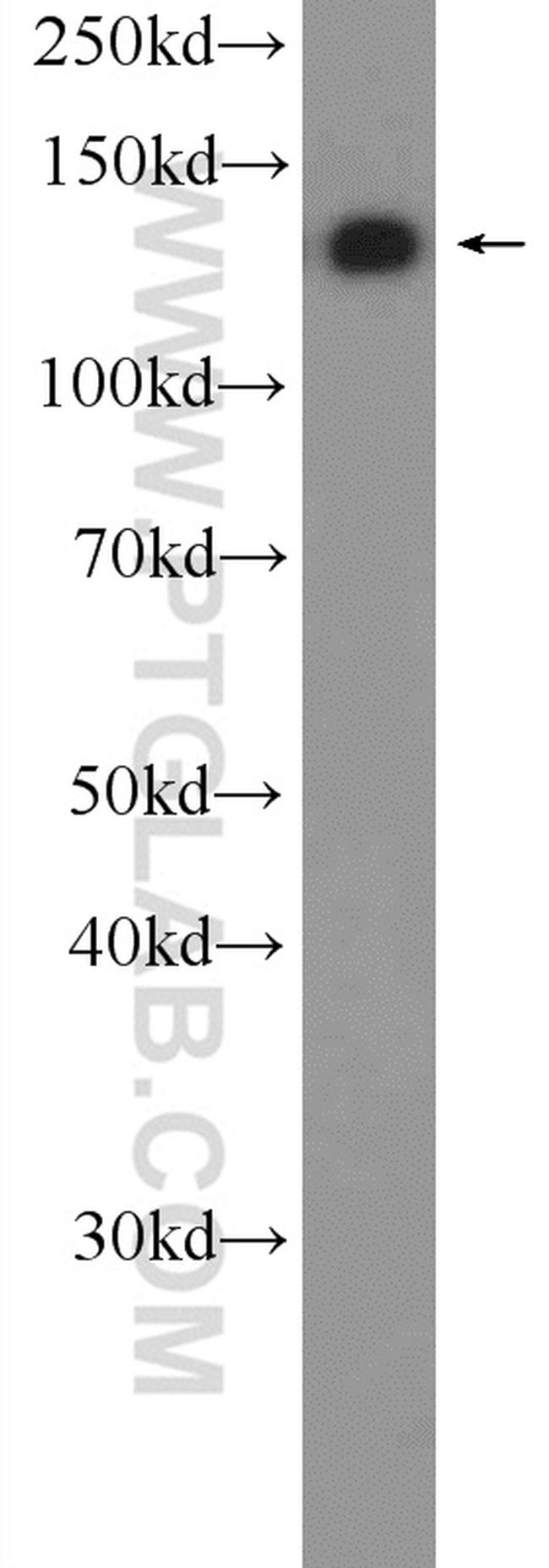 Raptor Antibody in Western Blot (WB)