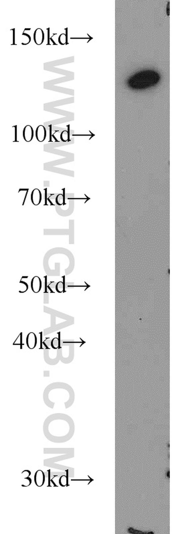 Raptor Antibody in Western Blot (WB)