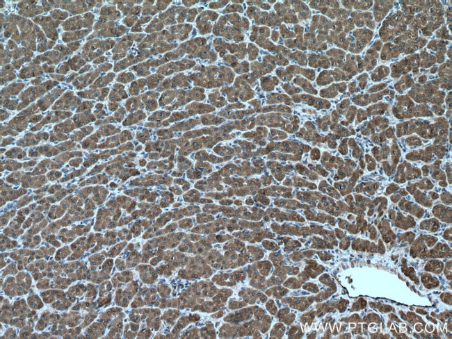 ULK1 Antibody in Immunohistochemistry (Paraffin) (IHC (P))