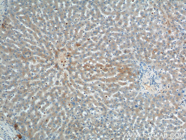 ULK1 Antibody in Immunohistochemistry (Paraffin) (IHC (P))