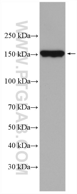 ULK1 Antibody in Western Blot (WB)