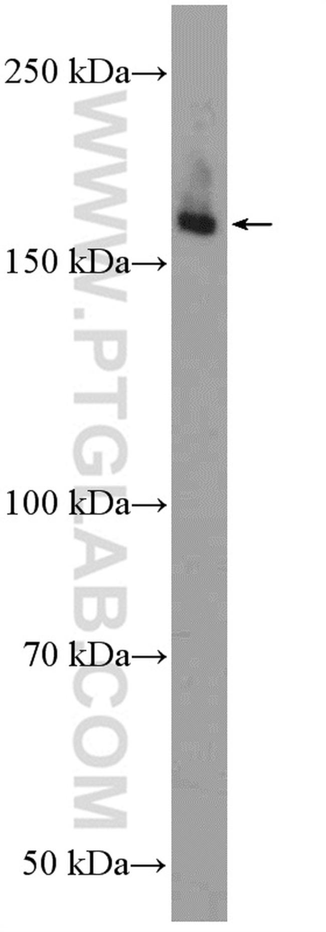 ULK1 Antibody in Western Blot (WB)