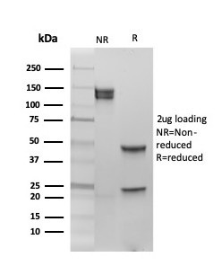 ER-beta (Estrogen Receptor beta-1) Antibody in SDS-PAGE (SDS-PAGE)