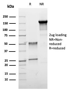 ER-beta-1 (Estrogen Receptor beta-1) Antibody in SDS-PAGE (SDS-PAGE)