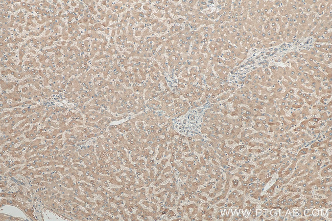 PDXDC1 Antibody in Immunohistochemistry (Paraffin) (IHC (P))