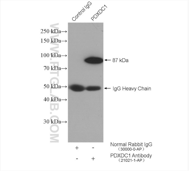 PDXDC1 Antibody in Immunoprecipitation (IP)