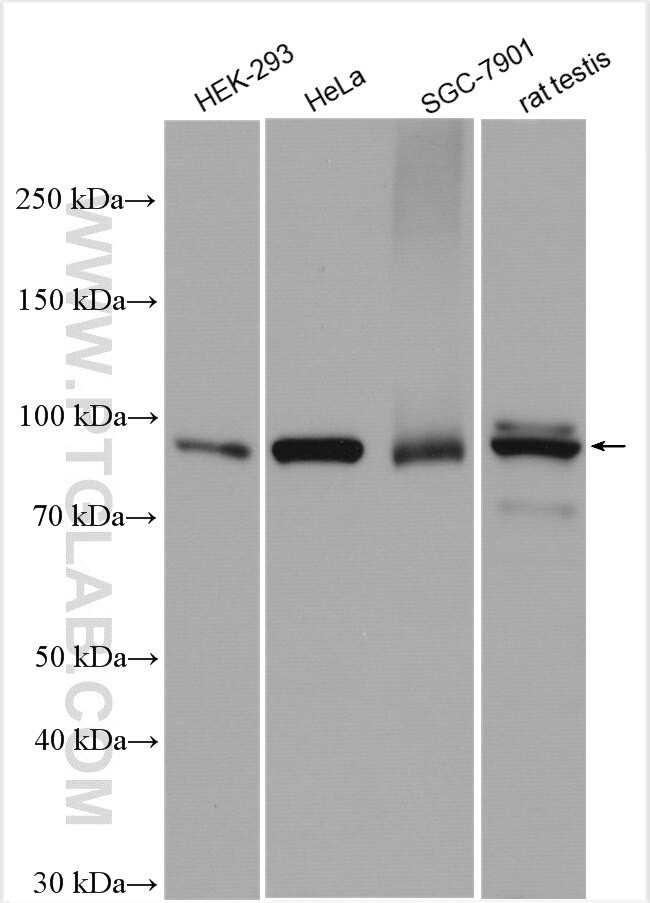 PDXDC1 Antibody in Western Blot (WB)