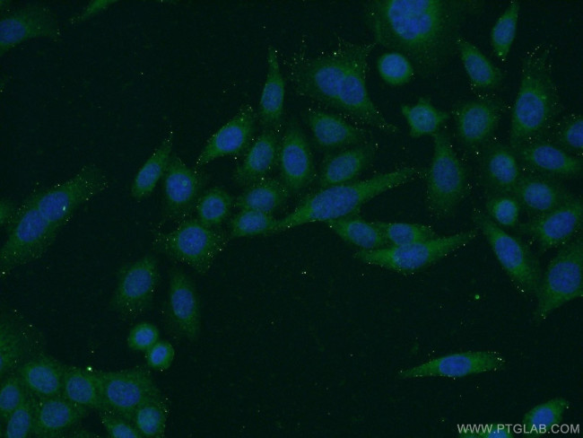 C1orf92 Antibody in Immunocytochemistry (ICC/IF)