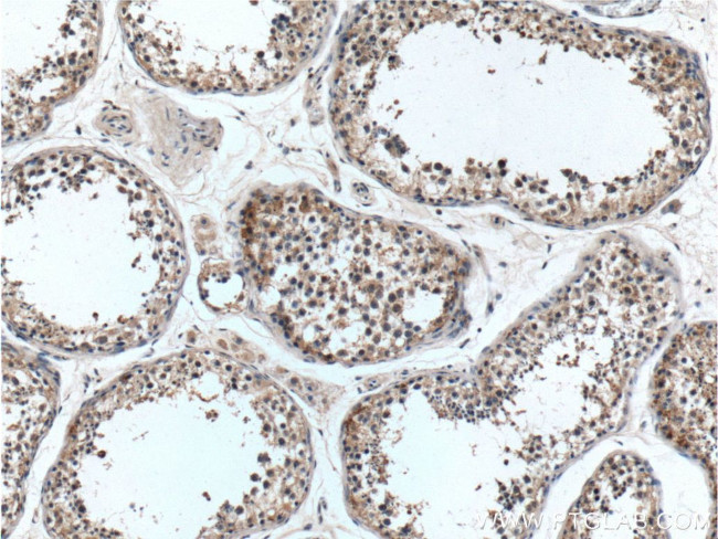 C9orf98 Antibody in Immunohistochemistry (Paraffin) (IHC (P))