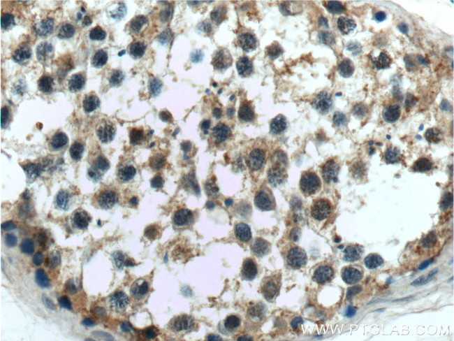 C9orf98 Antibody in Immunohistochemistry (Paraffin) (IHC (P))