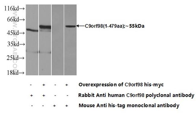 C9orf98 Antibody in Western Blot (WB)