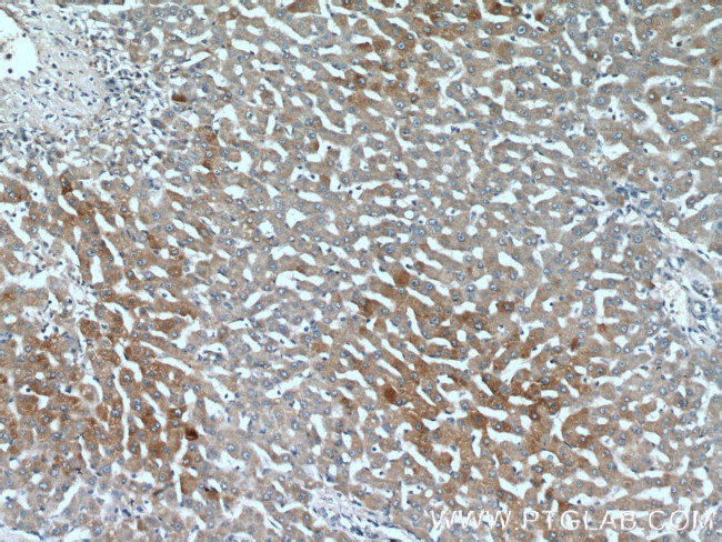 PML Antibody in Immunohistochemistry (Paraffin) (IHC (P))