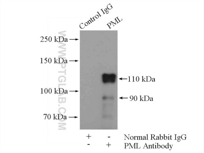 PML Antibody in Immunoprecipitation (IP)