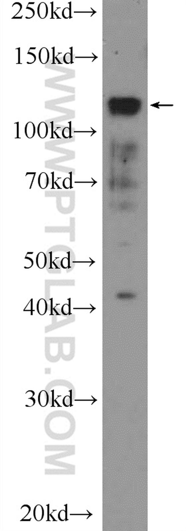 PML Antibody in Western Blot (WB)