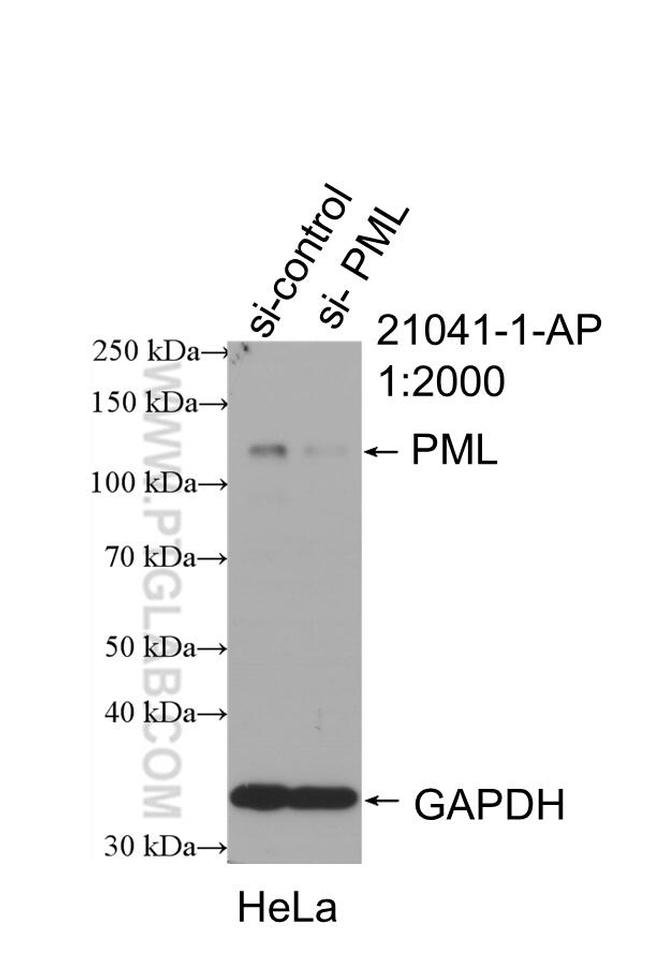 PML Antibody in Western Blot (WB)