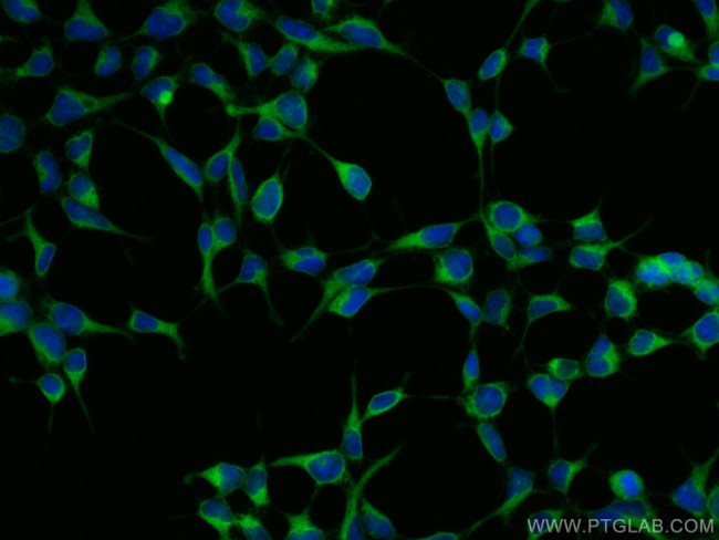 UBXD2 Antibody in Immunocytochemistry (ICC/IF)