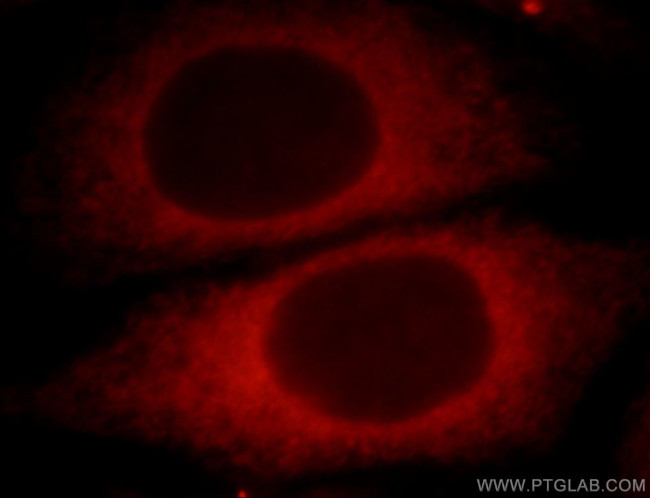 UBXD2 Antibody in Immunocytochemistry (ICC/IF)