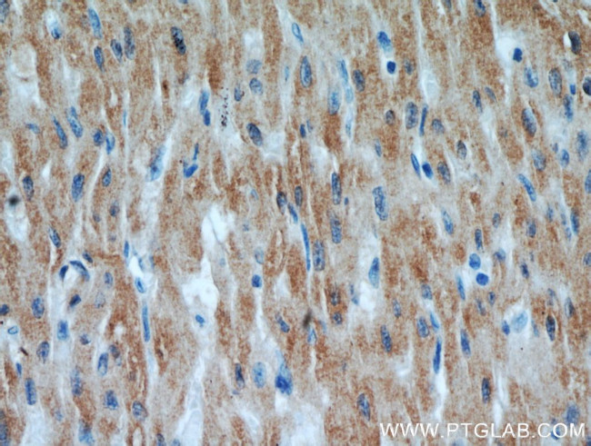 UBXD2 Antibody in Immunohistochemistry (Paraffin) (IHC (P))