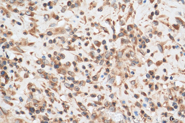 UBXD2 Antibody in Immunohistochemistry (Paraffin) (IHC (P))