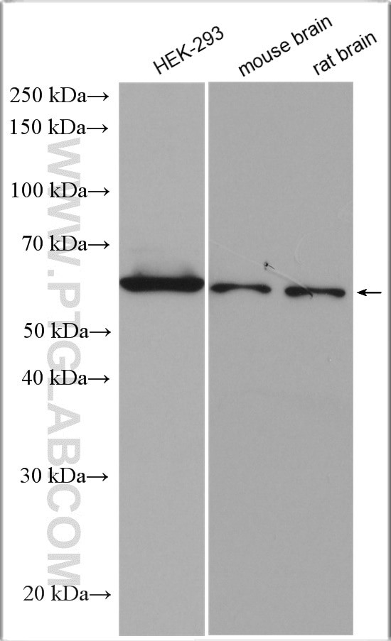 UBXD2 Antibody in Western Blot (WB)