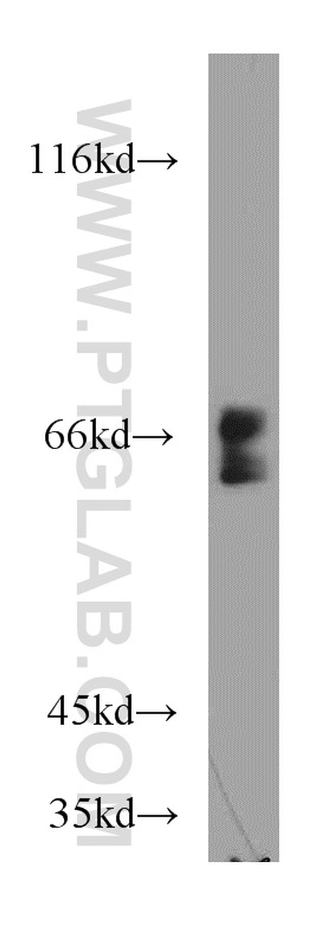 UBXD2 Antibody in Western Blot (WB)