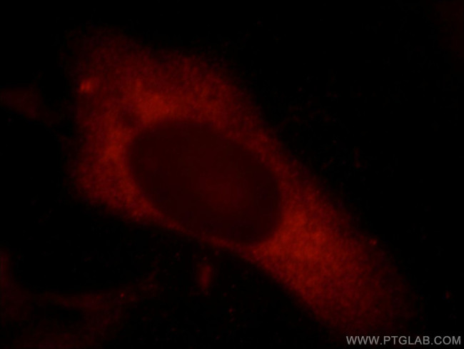 Synaptopodin Antibody in Immunocytochemistry (ICC/IF)