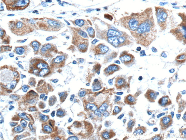 MEKK3 Antibody in Immunohistochemistry (Paraffin) (IHC (P))