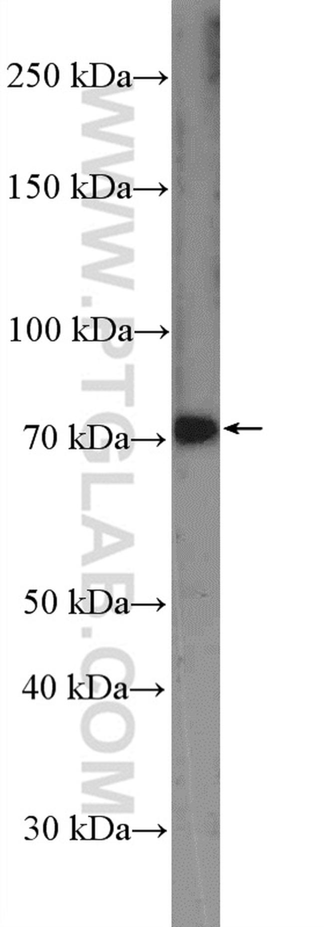 MEKK3 Antibody in Western Blot (WB)